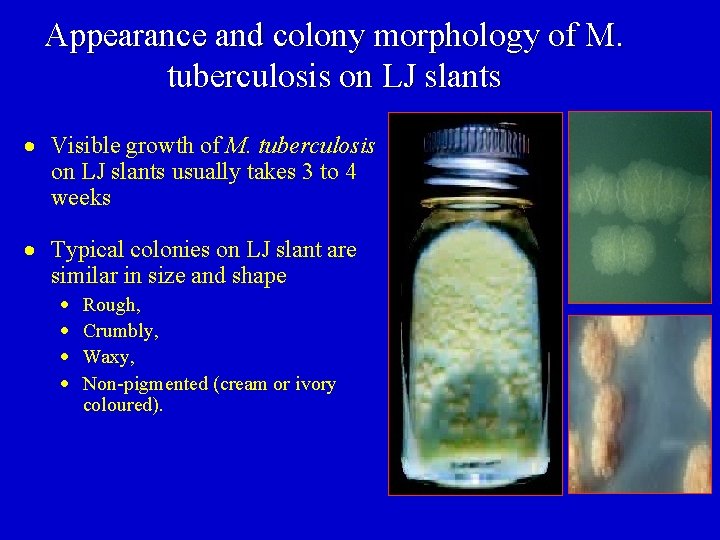 Appearance and colony morphology of M. tuberculosis on LJ slants Visible growth of M.