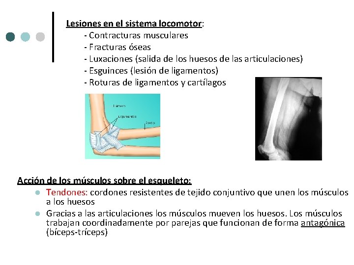 Lesiones en el sistema locomotor: - Contracturas musculares - Fracturas óseas - Luxaciones (salida Lesiones en el sistema locomotor: - Contracturas musculares - Fracturas óseas - Luxaciones (salida