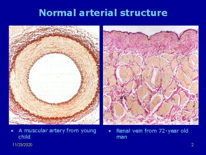 Normal arterial structure • A muscular artery from young child 11/23/2020 • Renal vein