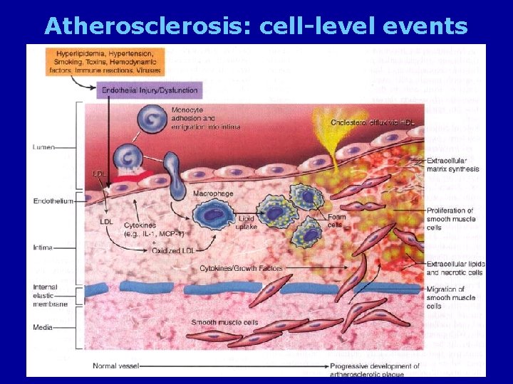 Atherosclerosis: cell-level events 11/23/2020 30 