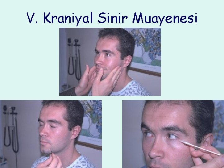 V. Kraniyal Sinir Muayenesi 