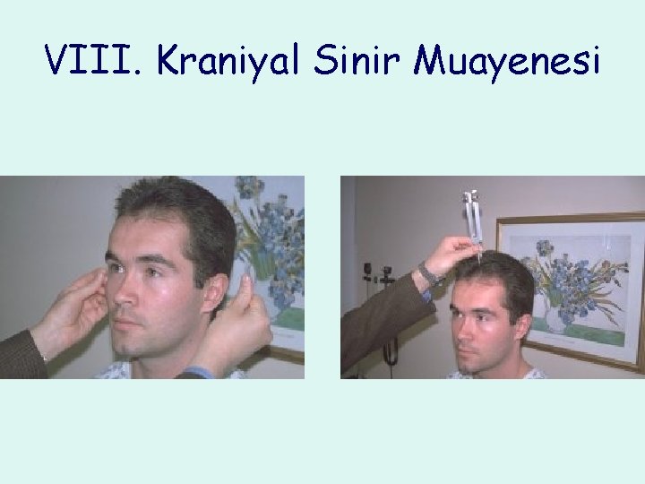 VIII. Kraniyal Sinir Muayenesi 