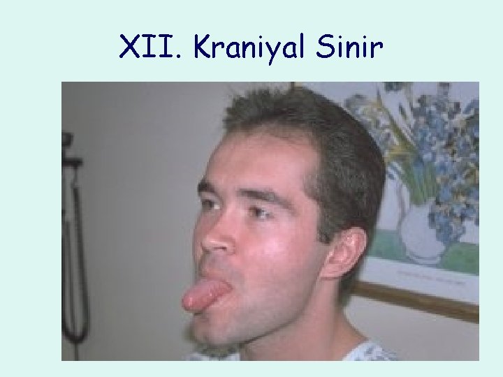 XII. Kraniyal Sinir 