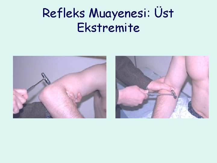 Refleks Muayenesi: Üst Ekstremite 