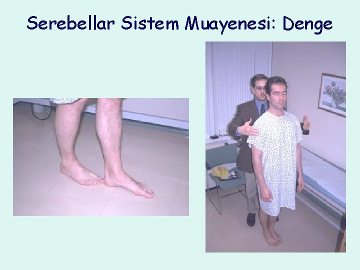 Serebellar Sistem Muayenesi: Denge 