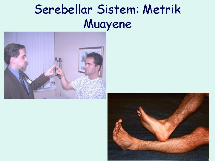 Serebellar Sistem: Metrik Muayene 