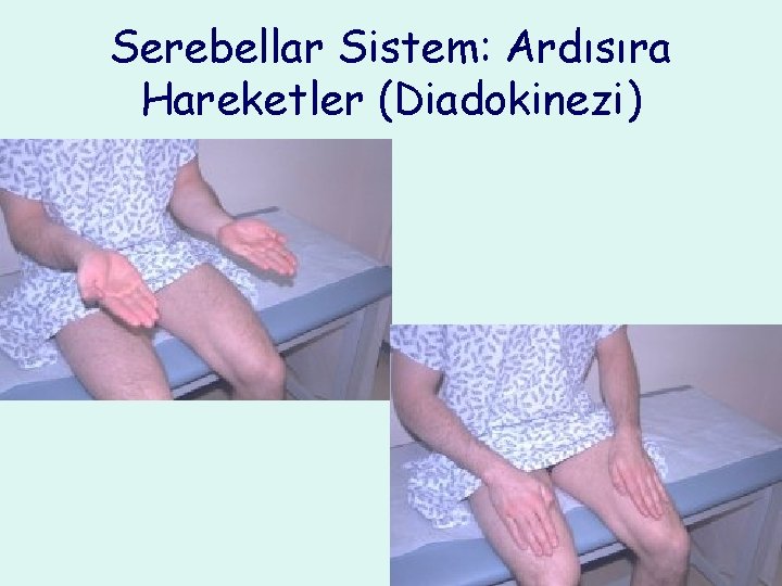 Serebellar Sistem: Ardısıra Hareketler (Diadokinezi) 
