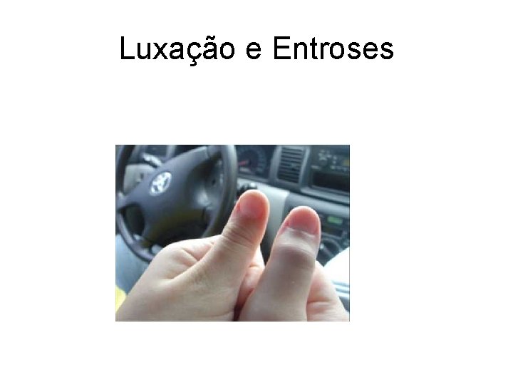 Luxação e Entroses 