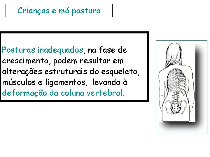 Crianças e má postura Posturas inadequados, na fase de crescimento, podem resultar em alterações