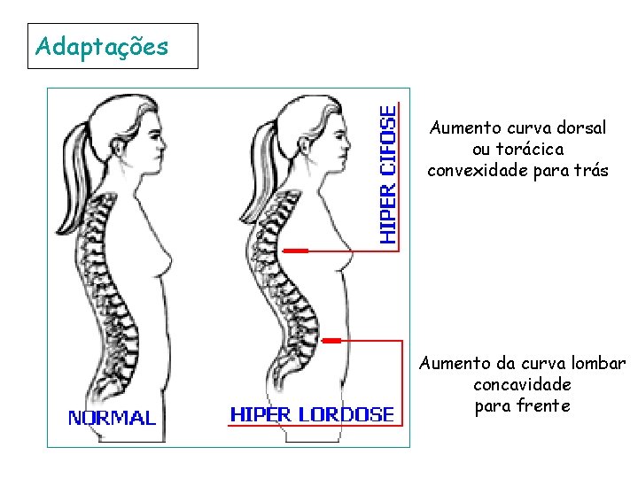 Adaptações Aumento curva dorsal ou torácica convexidade para trás Aumento da curva lombar concavidade