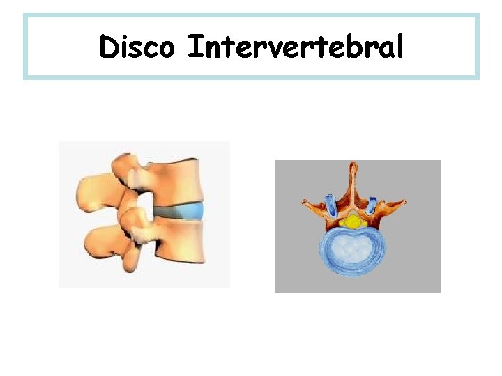 Disco Intervertebral 