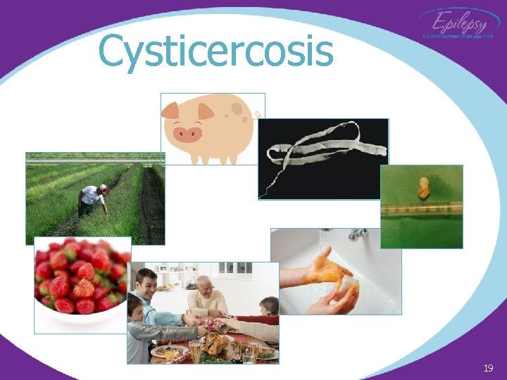 Cysticercosis 19 
