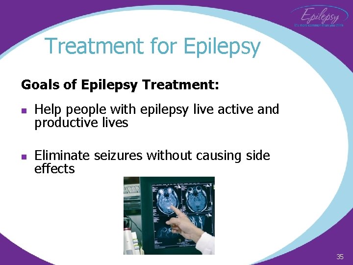 Treatment for Epilepsy Goals of Epilepsy Treatment: n Help people with epilepsy live active