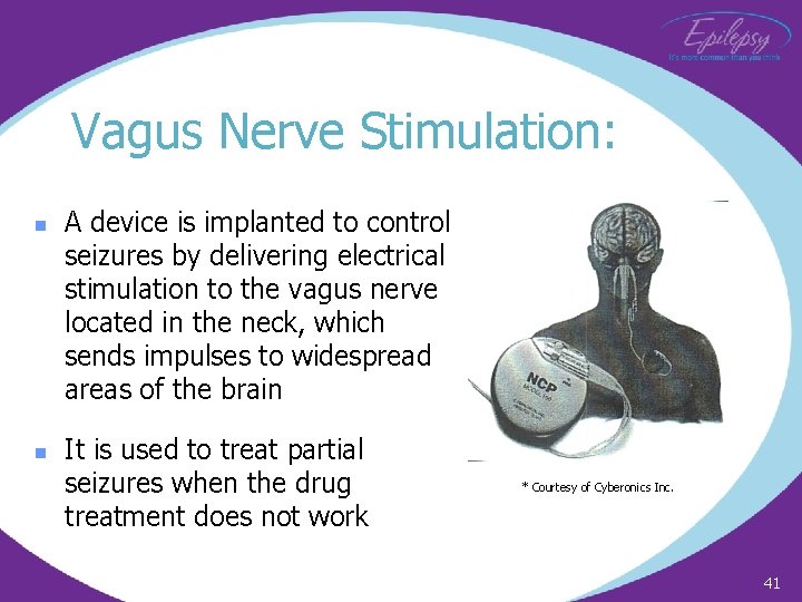 Vagus Nerve Stimulation: n n A device is implanted to control seizures by delivering