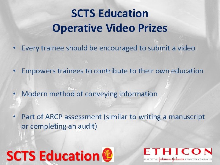 SCTS Education Operative Video Prizes • Every trainee should be encouraged to submit a