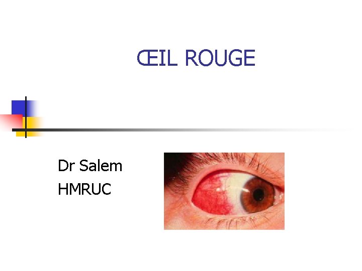 ŒIL ROUGE Dr Salem HMRUC 