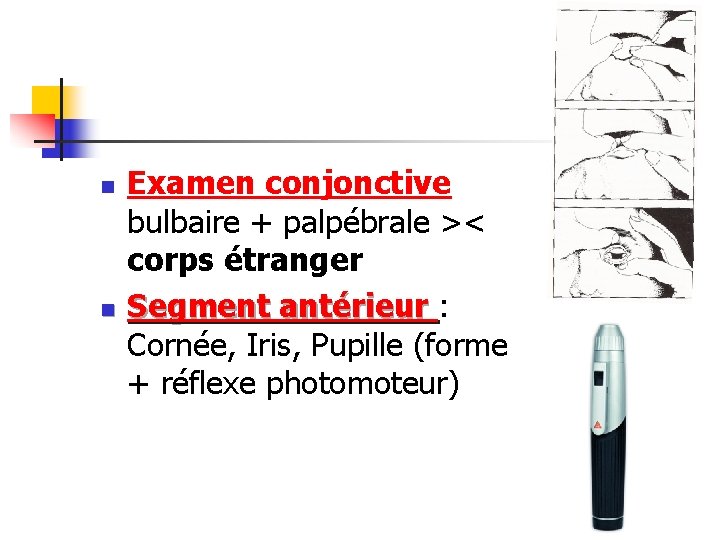 n n Examen conjonctive bulbaire + palpébrale >< corps étranger Segment antérieur : Cornée,