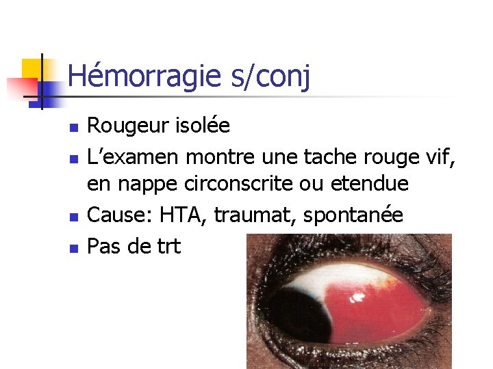 Hémorragie s/conj n n Rougeur isolée L’examen montre une tache rouge vif, en nappe