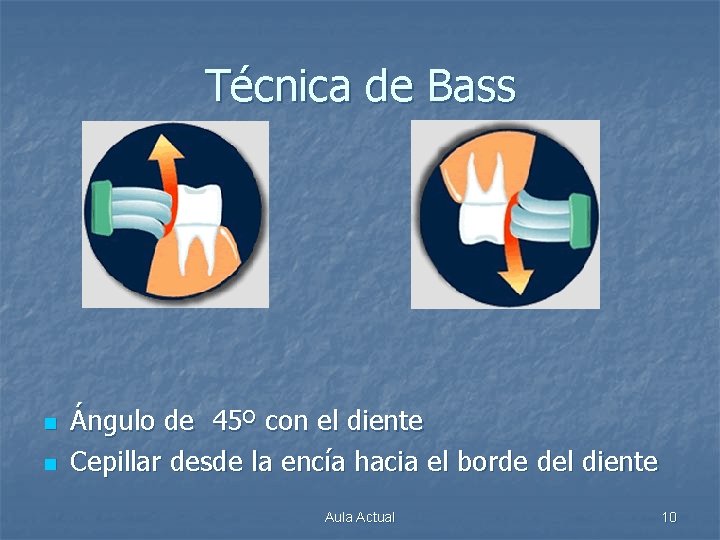 Técnica de Bass n n Ángulo de 45º con el diente Cepillar desde la