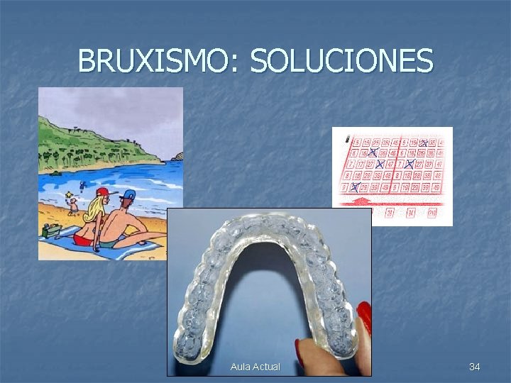 BRUXISMO: SOLUCIONES Aula Actual 34 