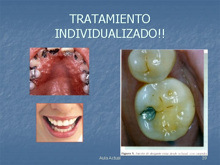 TRATAMIENTO INDIVIDUALIZADO!! Aula Actual 39 