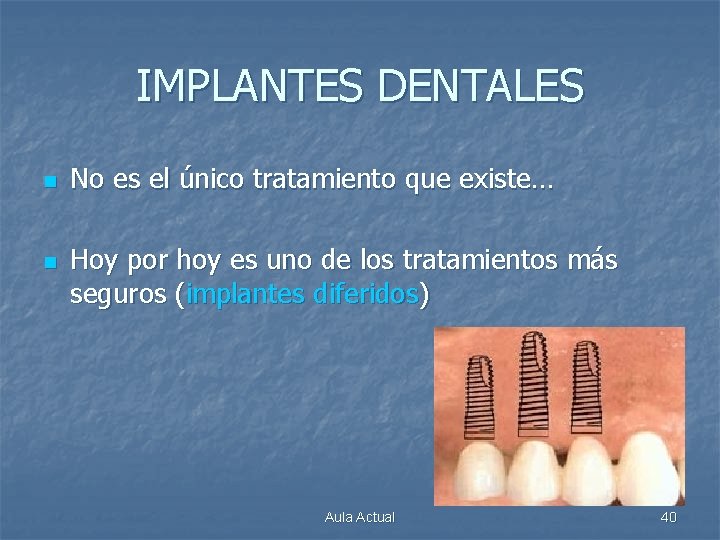 IMPLANTES DENTALES n n No es el único tratamiento que existe… Hoy por hoy