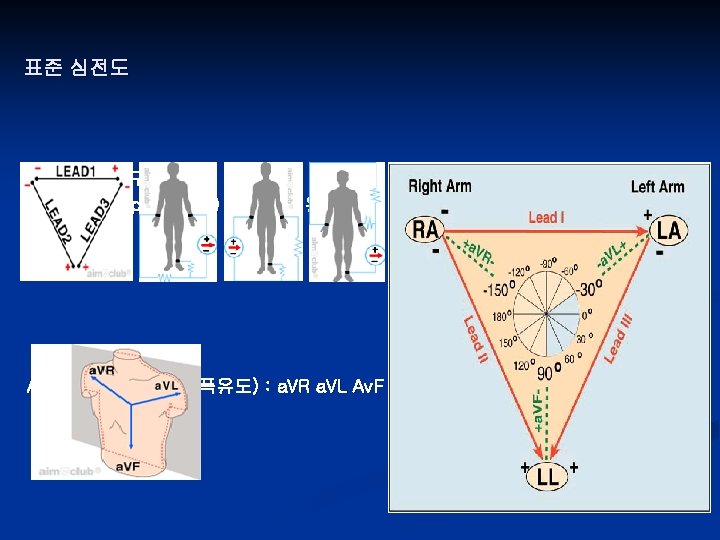 표준 심전도 12 leads 로 구성 Standard (bipolar limb) lead(사지유도) Augmented leads(증폭유도) : a.