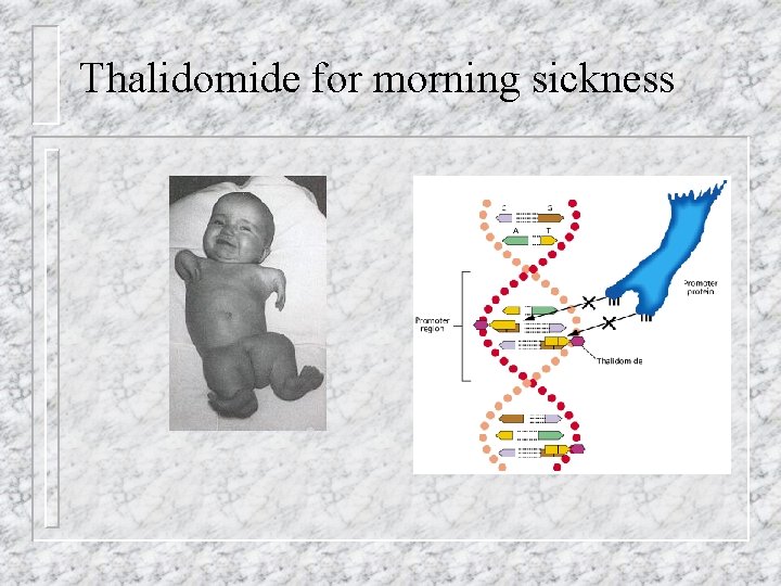 Thalidomide for morning sickness 