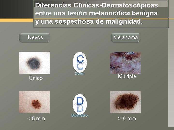 Diferencias Clínicas-Dermatoscópicas entre una lesión melanocítica benigna y una sospechosa de malignidad. Nevos Melanoma