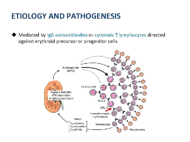 ETIOLOGY AND PATHOGENESIS u Mediated by Ig. G autoantibodies or cytotoxic T lymphocytes directed