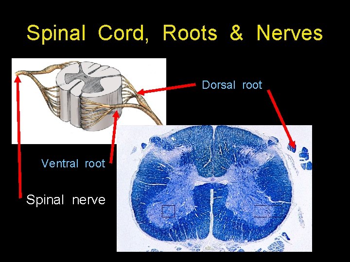 Spinal Cord, Roots & Nerves Dorsal root Ventral root Spinal nerve 