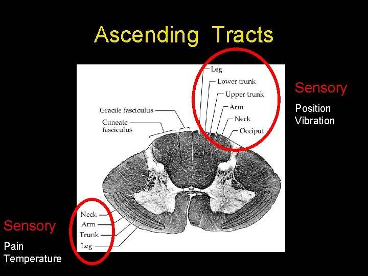 Ascending Tracts Sensory Position Vibration Sensory Pain Temperature 