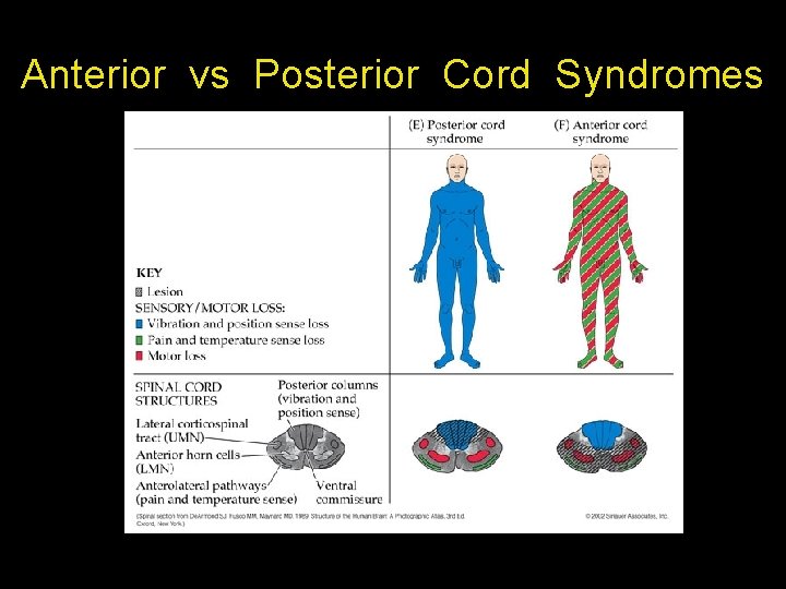 Anterior vs Posterior Cord Syndromes 