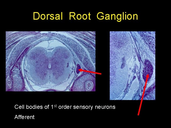 Dorsal Root Ganglion Cell bodies of 1 st order sensory neurons Afferent 