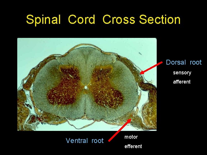 Spinal Cord Cross Section Dorsal root sensory afferent Ventral root motor efferent Spinal Cord Cross Section Dorsal root sensory afferent Ventral root motor efferent