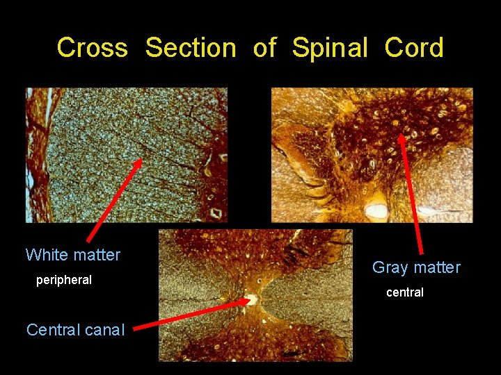 Cross Section of Spinal Cord White matter peripheral Central canal Gray matter central Cross Section of Spinal Cord White matter peripheral Central canal Gray matter central