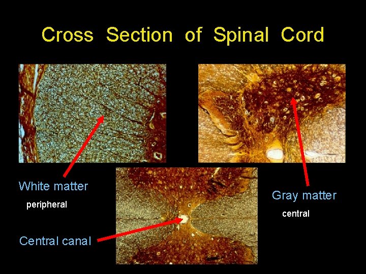 Cross Section of Spinal Cord White matter peripheral Central canal Gray matter central 