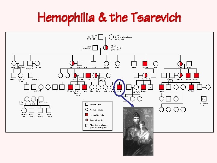 Hemophilia & the Tsarevich 
