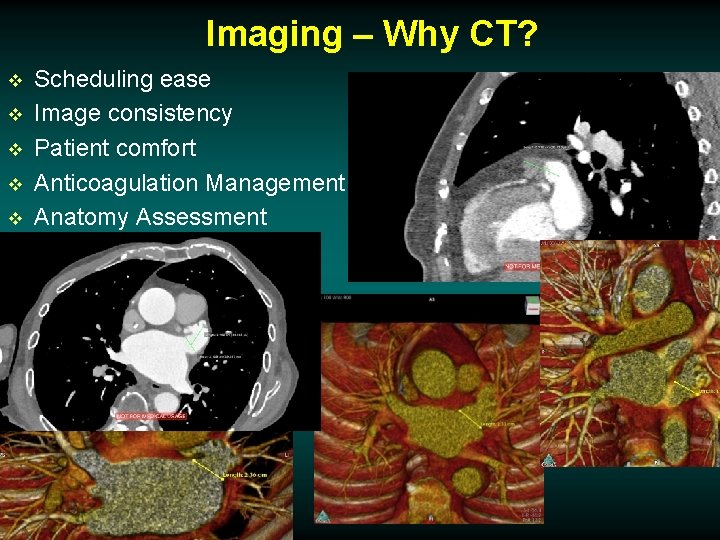 Imaging – Why CT? v v v Scheduling ease Image consistency Patient comfort Anticoagulation