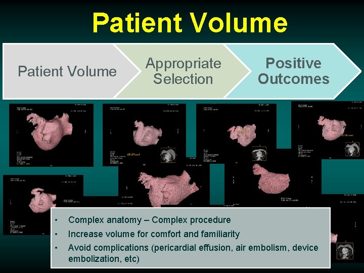 Patient Volume • • • Appropriate Selection Positive Outcomes Complex anatomy – Complex procedure