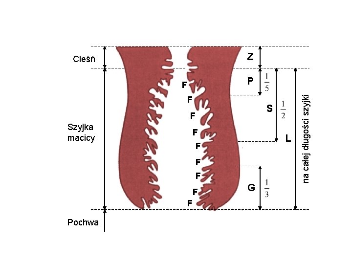 Z Cieśń F Szyjka macicy F L F F F Pochwa G na całej
