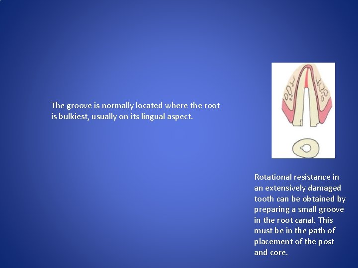 The groove is normally located where the root is bulkiest, usually on its lingual