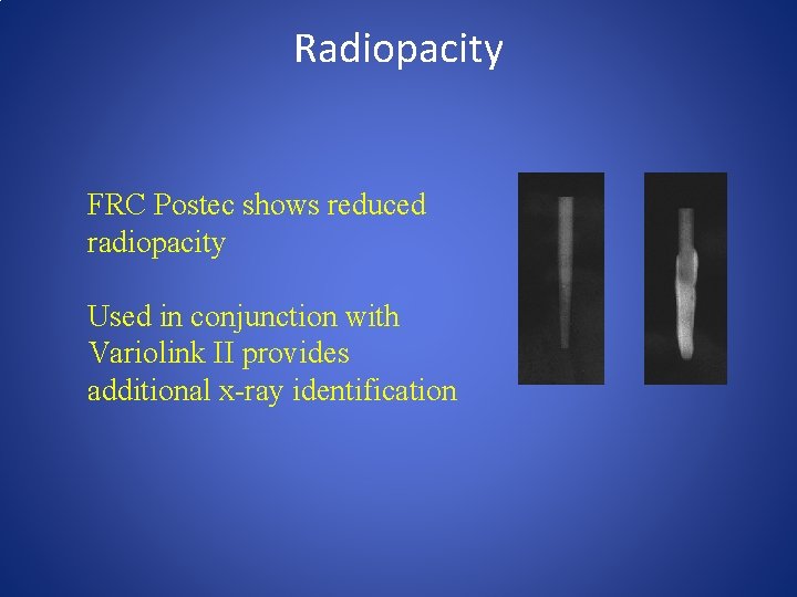 Radiopacity FRC Postec shows reduced radiopacity Used in conjunction with Variolink II provides additional
