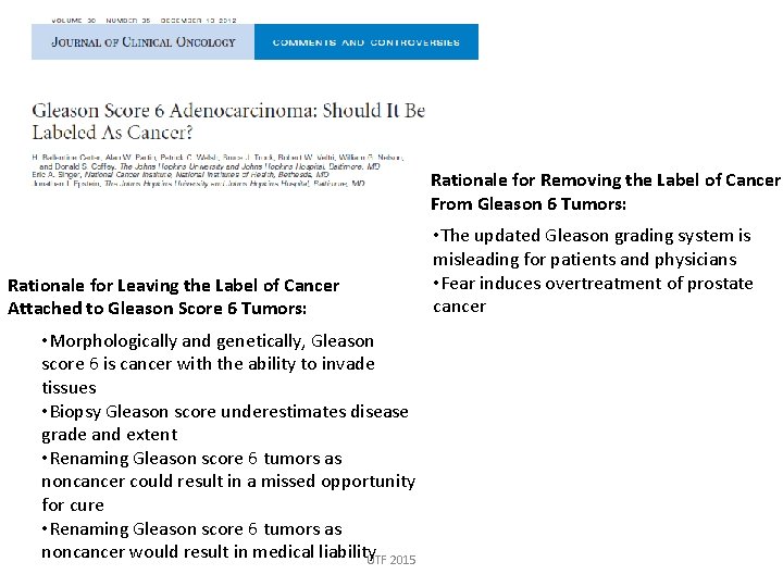 Rationale for Removing the Label of Cancer From Gleason 6 Tumors: Rationale for Leaving