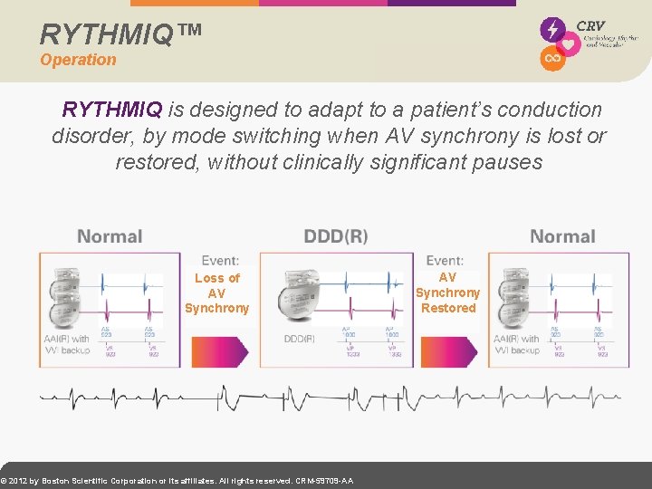 RYTHMIQ™ Operation RYTHMIQ is designed to adapt to a patient’s conduction disorder, by mode