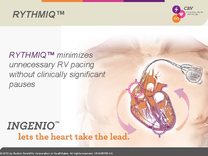 RYTHMIQ™ minimizes unnecessary RV pacing without clinically significant pauses © 2012 by Boston Scientific