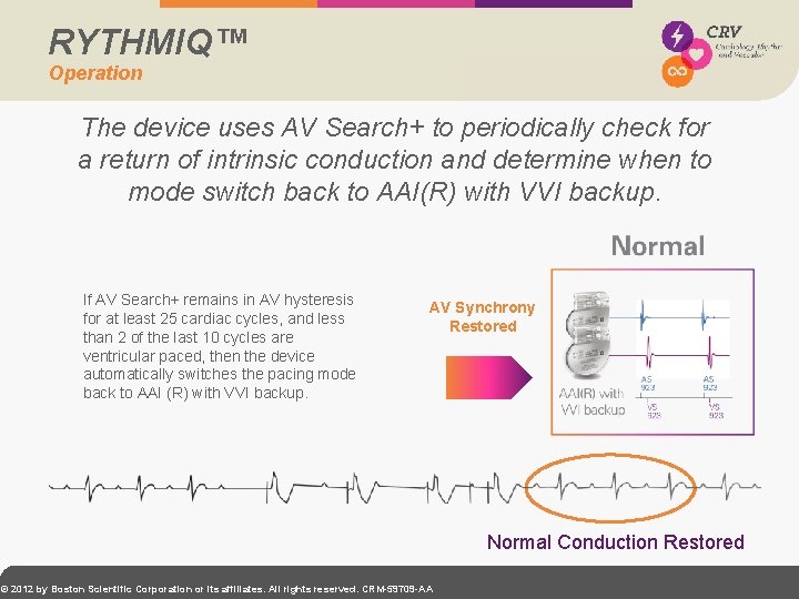 RYTHMIQ™ Operation The device uses AV Search+ to periodically check for a return of