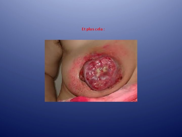 Et plus cela : Et plus cela :
