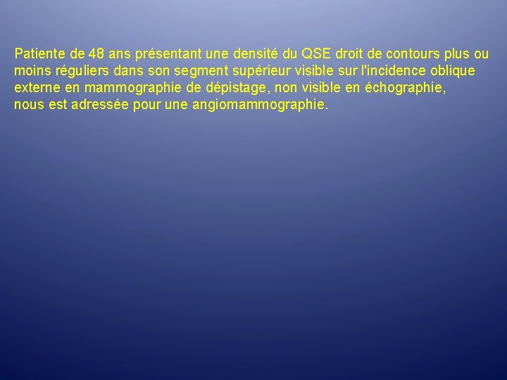 Patiente de 48 ans présentant une densité du QSE droit de contours plus ou Patiente de 48 ans présentant une densité du QSE droit de contours plus ou