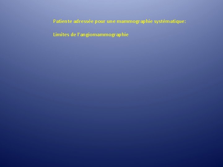 Patiente adressée pour une mammographie systématique: Limites de l’angiomammographie Patiente adressée pour une mammographie systématique: Limites de l’angiomammographie